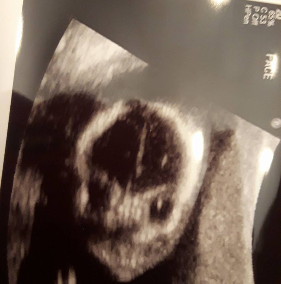 37410784_10100969331134497_7473045797127323648_n